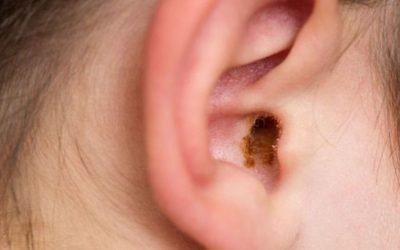 How to Clean Your Ears the Correct and Safe Way